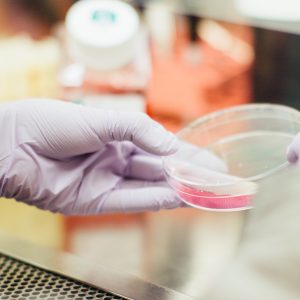 gloved hands holding petri dish