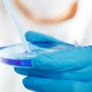 lab researcher holding petri dish