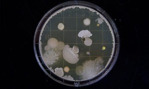 bacteria growing in a petri dish