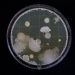 bacteria growing in a petri dish