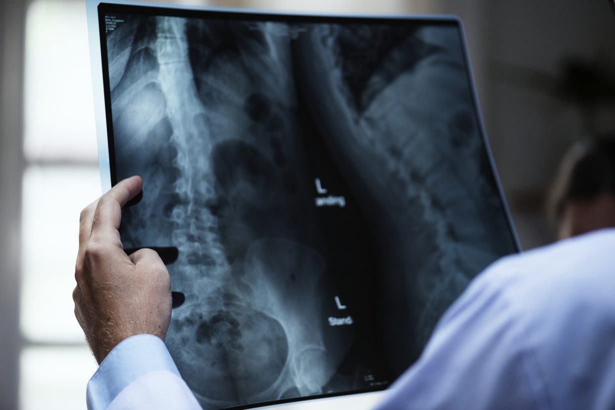 doctor holding an extra of someones's spine