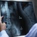 doctor holding an extra of someones's spine