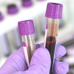 gloved hand holding two blood sample vials