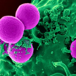 close up of white blood cells