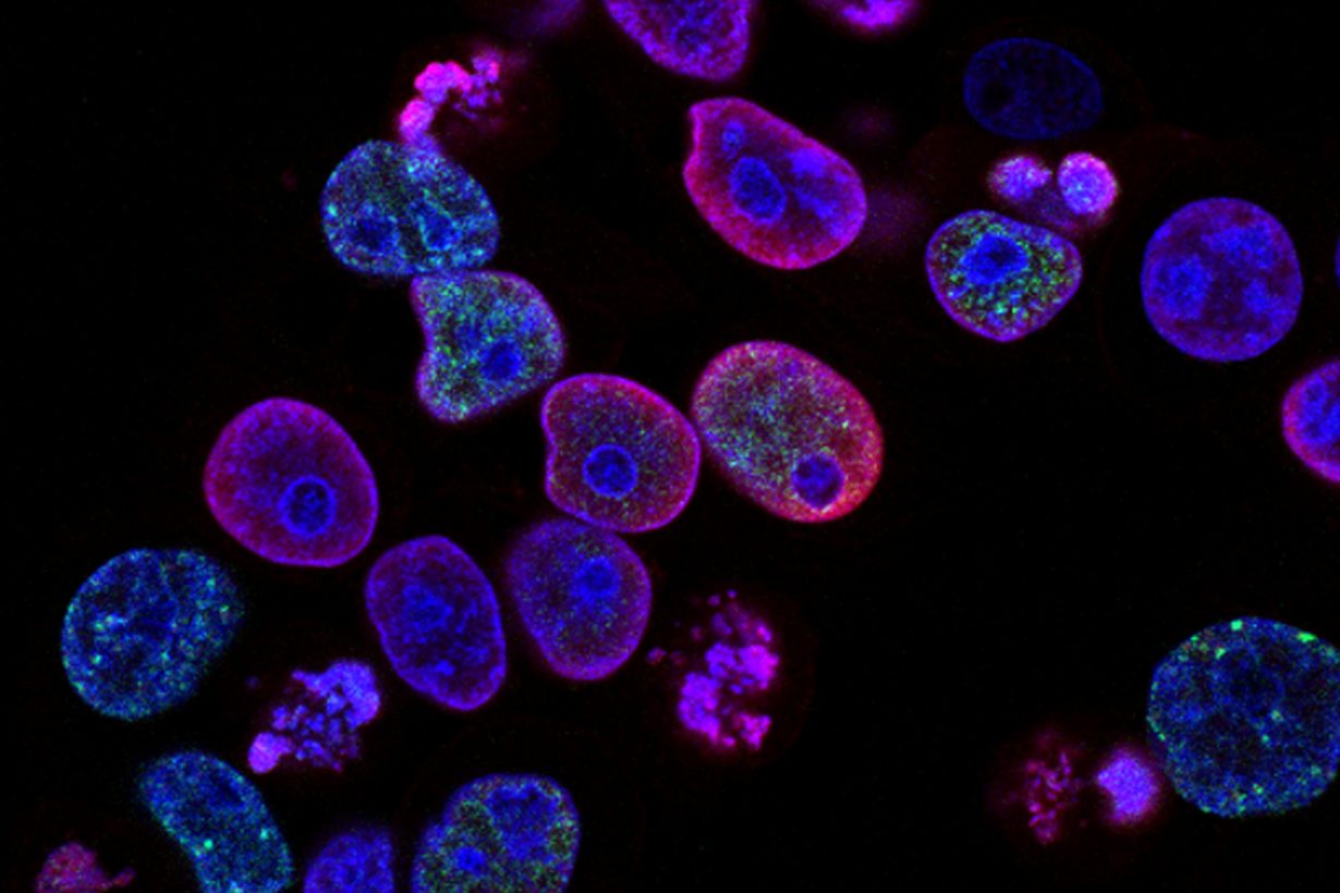 purple cancer cells