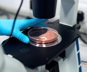 person holding a petri dish under a microscope