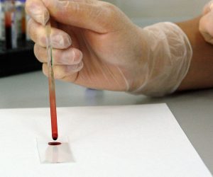 gloved hand putting blood on a microscope lens
